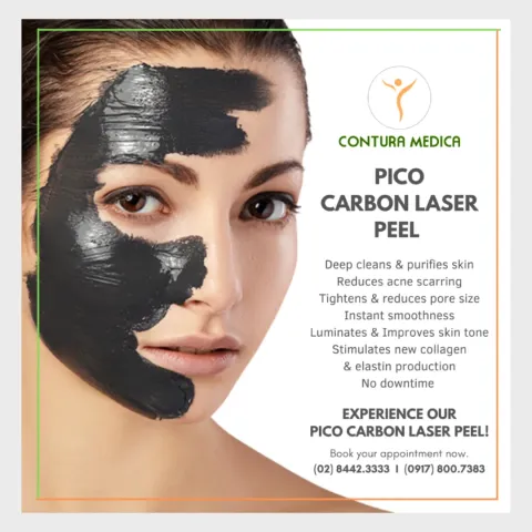 Promotional graphic for a carbon laser peel: a woman with a black mask on half her face beside a list of benefits and booking details.