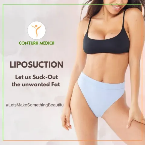Promotional graphic for liposuction: a woman in a black top and pale blue briefs beside the headline LIPOSUCTION on a pastel background.